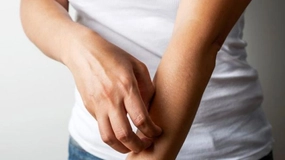 Kaşıntı Belirtileri ve Tedavisi